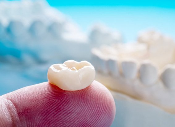 Dental crown balanced on finger